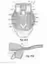 Fig. 13 - LINEAR MOTION DELIVERY SYSTEM FOR FEMALE STERILIZATION DEVICE