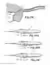 Fig. 15 - LINEAR MOTION DELIVERY SYSTEM FOR FEMALE STERILIZATION DEVICE