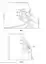 Fig. 05 - PROTECTIVE DEVICE FOR IMPLANTED MEDICAL DEVICE
