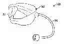 Fig. 01 - METHOD AND SYSTEM FOR SIZING AN ORAL DEVICE