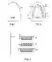 Fig. 02 - METHOD AND SYSTEM FOR SIZING AN ORAL DEVICE