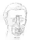 Fig. 18 - Apparatus for improved breathing