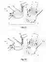 Fig. 12 - System and method to position and retain a sensor in a faucet spout