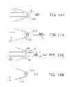 Fig. 07 - Shock wave modification method and system
