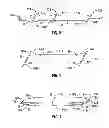 Fig. 04 - Blunt tip vial access cannula and method for manufacture