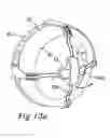 Fig. 24 - Anti slip device for a wheel and a method for mounting the anti slip device