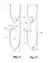 Fig. 22 - Covering for architectural opening including cell structures biased to open
