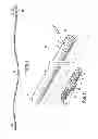 Fig. 07 - Surgical tilt anvil assembly