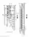 Fig. 09 - Staple position sensor system