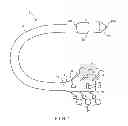 Fig. 02 - Circumferential Full Thickness Resectioning Device