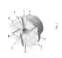 Fig. 09 - FLUID INJECTOR