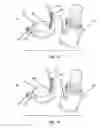 Fig. 12 - System and method for manually overriding a solenoid valve of a faucet
