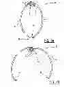 Fig. 04 - Pipe Travelling Apparatus and Use Thereof