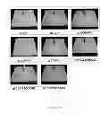 Fig. 23 - Process for particleboard manufacture