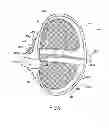 Fig. 04 - Floating game device