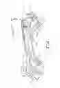 Fig. 06 - Skate sole assembly