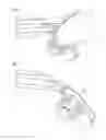 Fig. 05 - Interior panel component with insert for an airbag covering and method for producing the interior panel component
