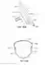 Fig. 08 - Adjustable grip steering wheel safety system to protect hands and upper extremities in low impact collisions