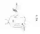 Fig. 153 - Infusion pump assembly