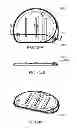 Fig. 157 - Infusion pump assembly