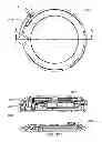Fig. 160 - Infusion pump assembly
