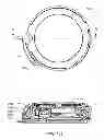 Fig. 162 - Infusion pump assembly
