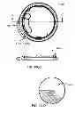 Fig. 164 - Infusion pump assembly