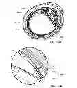 Fig. 168 - Infusion pump assembly