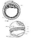 Fig. 169 - Infusion pump assembly