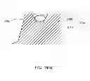 Fig. 170 - Infusion pump assembly