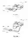 Fig. 207 - Infusion pump assembly