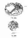 Fig. 211 - Infusion pump assembly