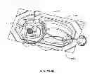 Fig. 216 - Infusion pump assembly