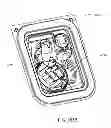 Fig. 218 - Infusion pump assembly
