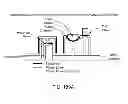 Fig. 228 - Infusion pump assembly