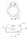 Fig. 233 - Infusion pump assembly