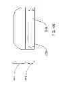 Fig. 234 - Infusion pump assembly