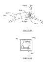 Fig. 238 - Infusion pump assembly