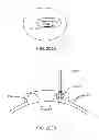 Fig. 241 - Infusion pump assembly