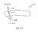 Fig. 243 - Infusion pump assembly