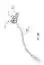 Fig. 244 - Infusion pump assembly