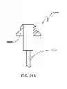 Fig. 254 - Infusion pump assembly