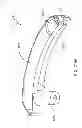 Fig. 256 - Infusion pump assembly
