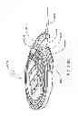 Fig. 261 - Infusion pump assembly