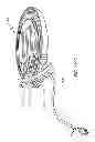 Fig. 262 - Infusion pump assembly