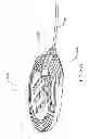 Fig. 267 - Infusion pump assembly