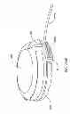 Fig. 273 - Infusion pump assembly