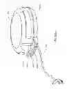 Fig. 276 - Infusion pump assembly