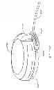 Fig. 277 - Infusion pump assembly
