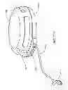 Fig. 278 - Infusion pump assembly